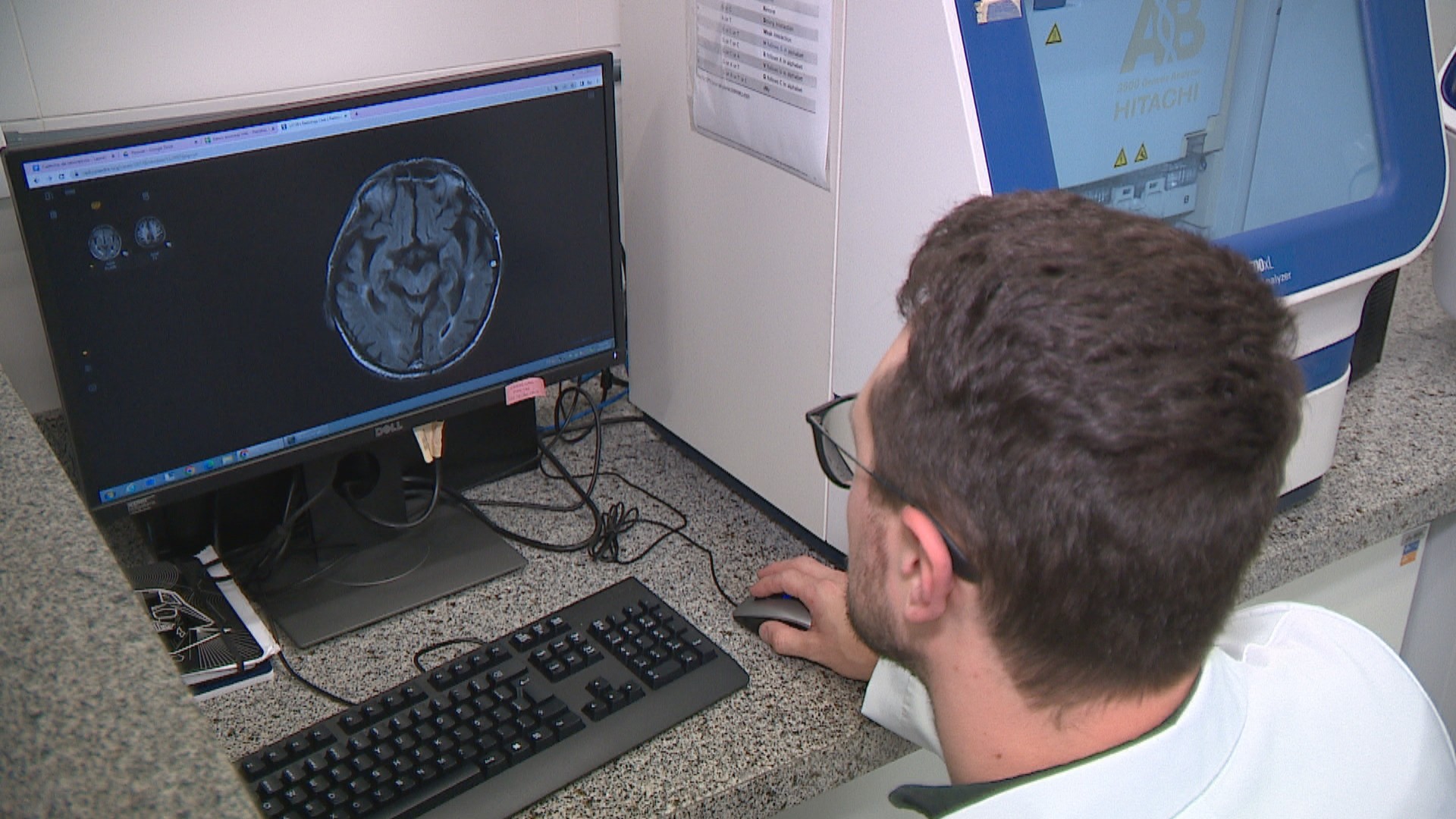 Esquecimento normal ou sinal de Alzheimer? Veja como diferenciar e quando buscar ajuda