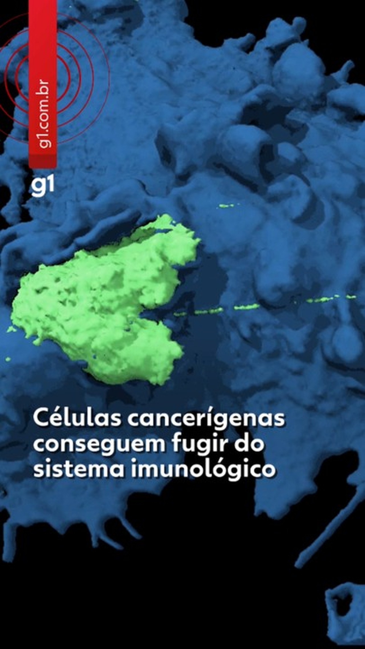Vídeo mostra células de câncer escapando do sistema imunológico e explica como doença avança