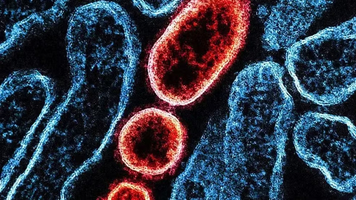 OMS dispensa restrições de viagem à Índia após casos de Nipah e aponta baixo risco de propagação