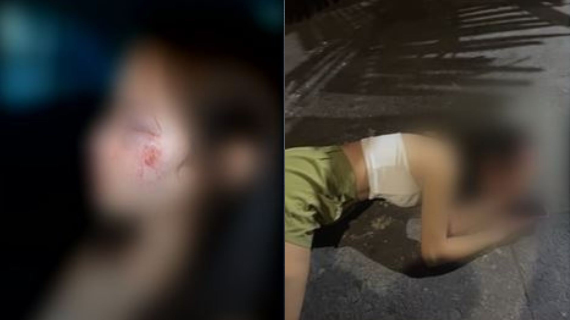 Mulher é agredida na saída de boate, em Goiânia