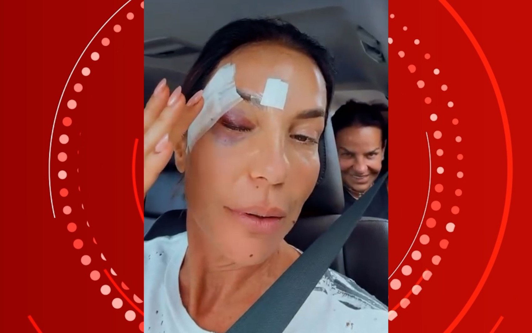 Síncope vasovagal: entenda a condição que levou Ivete Sangalo a desmaiar e se machucar