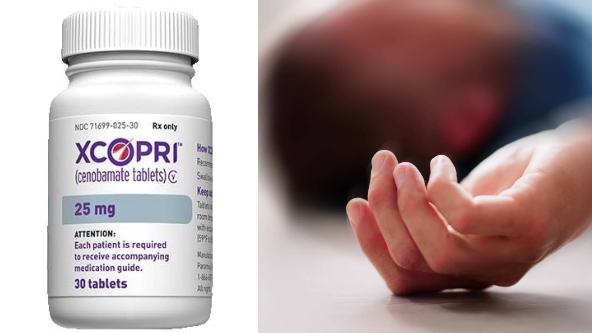 Tratamento aprovado para epilepsia promete reduzir crises graves; médico fala em 'mudança de paradigma'
