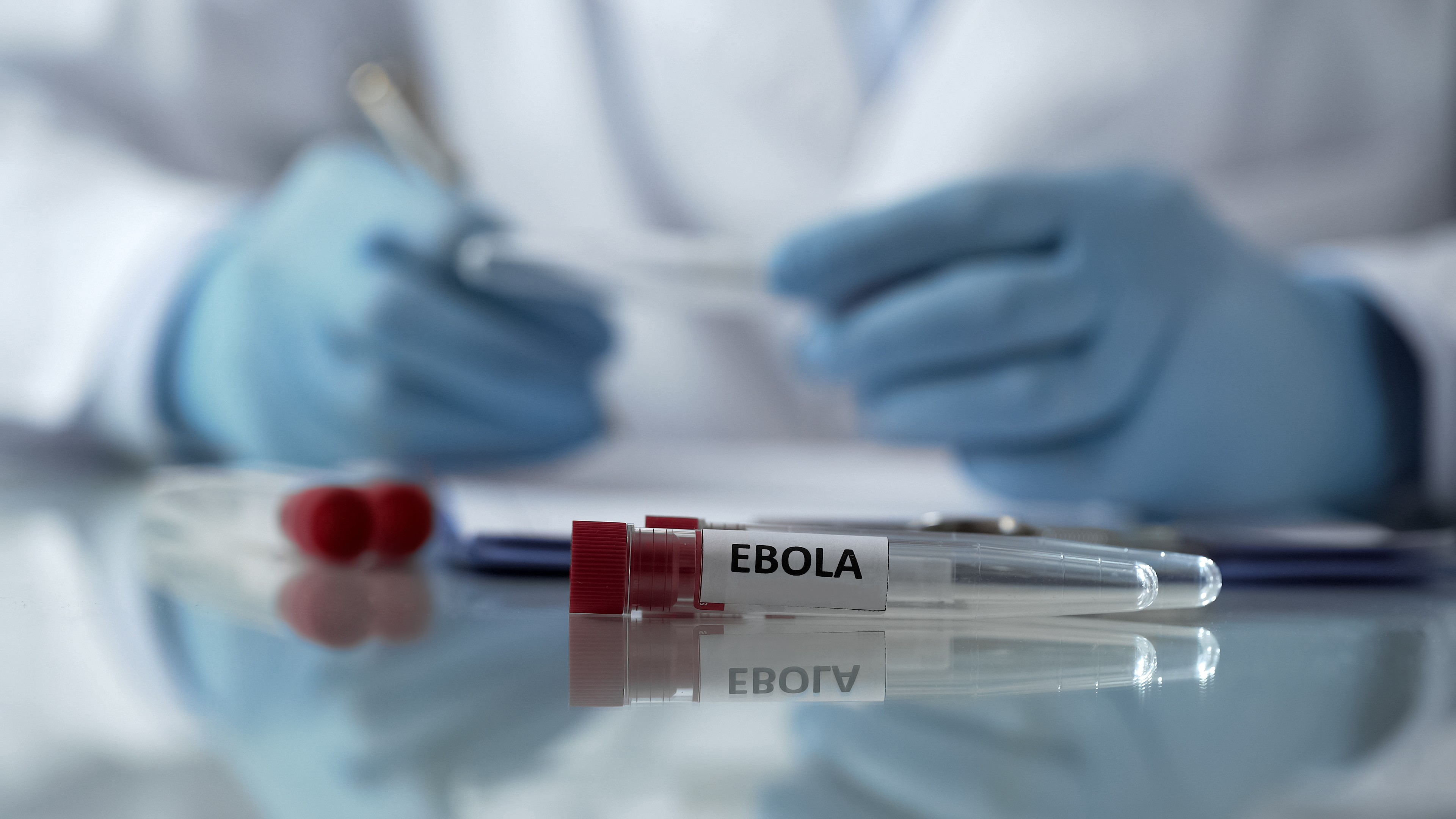 Suspeita de Ebola é descartada em pacientes no Rio e em SP: o que se sabe