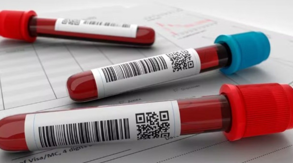 SUS incorpora novo tratamento para leucemia mieloide aguda em adultos