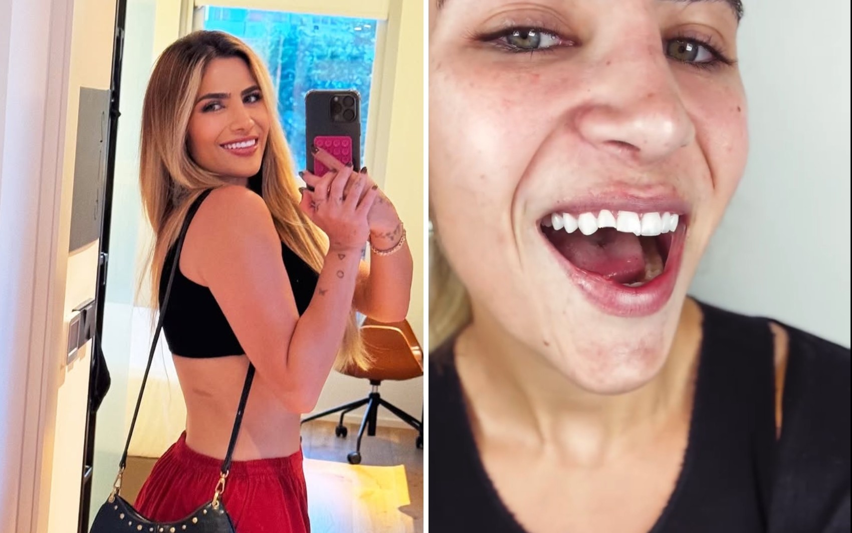 Filha de Leonardo quebra dente após cair em noite romântica: 'Desastre'